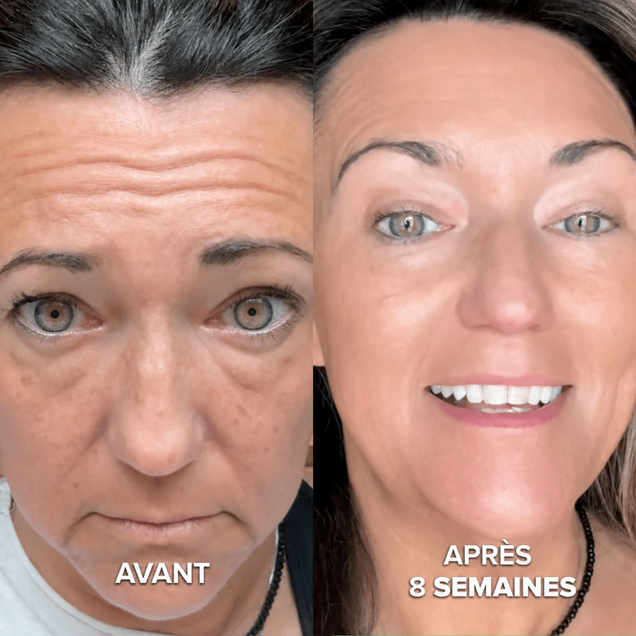 Baume au Collagène